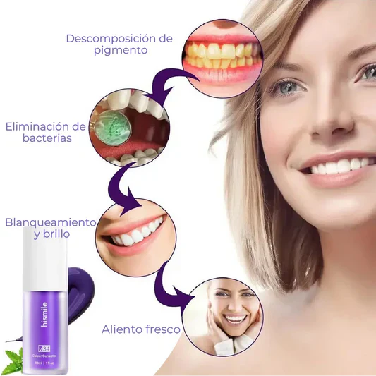 Hismile v34 - Crema Blanqueadora Dental
