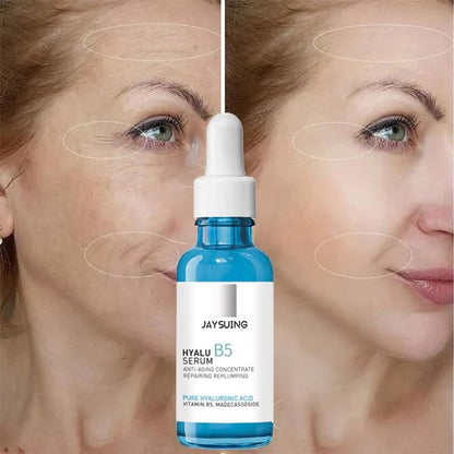 Hyalu B5 Serum - Suero de ácido hialurónico puro